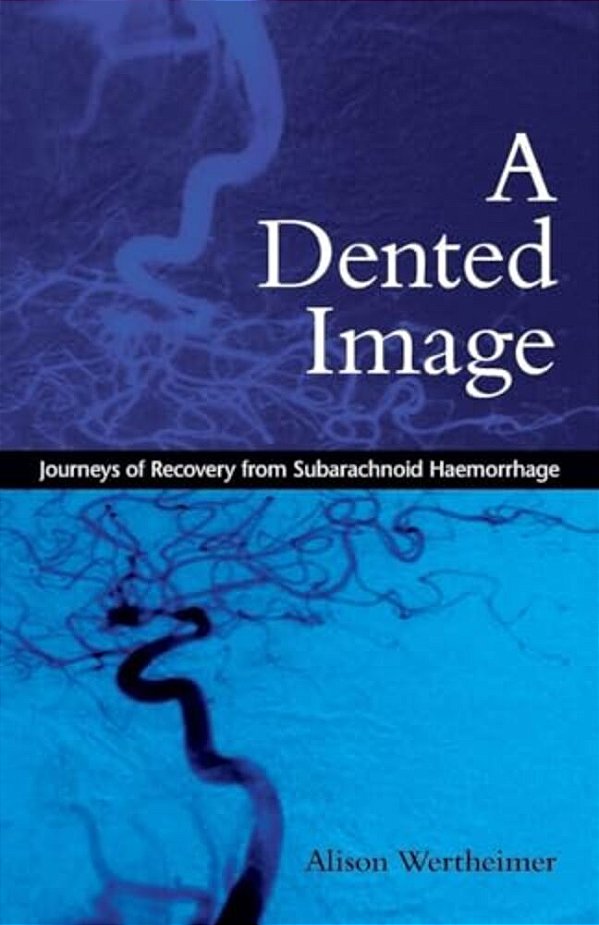 A Dented Image: Journeys Of Recovery From Subarachnoid Haemorrhage-..