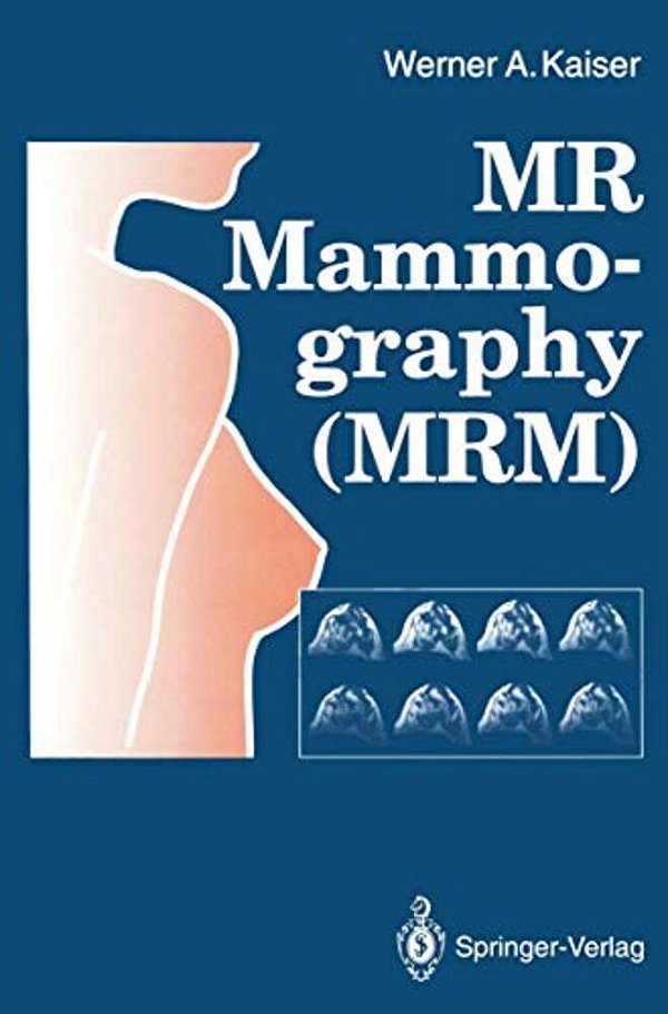 Mr Mammography (Mrm)-..
