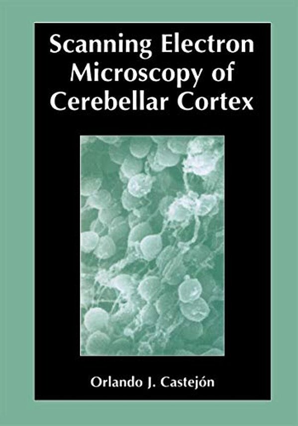 Scanning Electron Microscopy Of Cerebellar Cortex-..