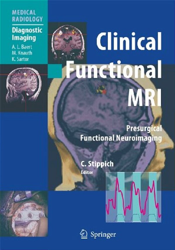 Clinical Functional Mri: Presurgical Functional Neuroimaging-..