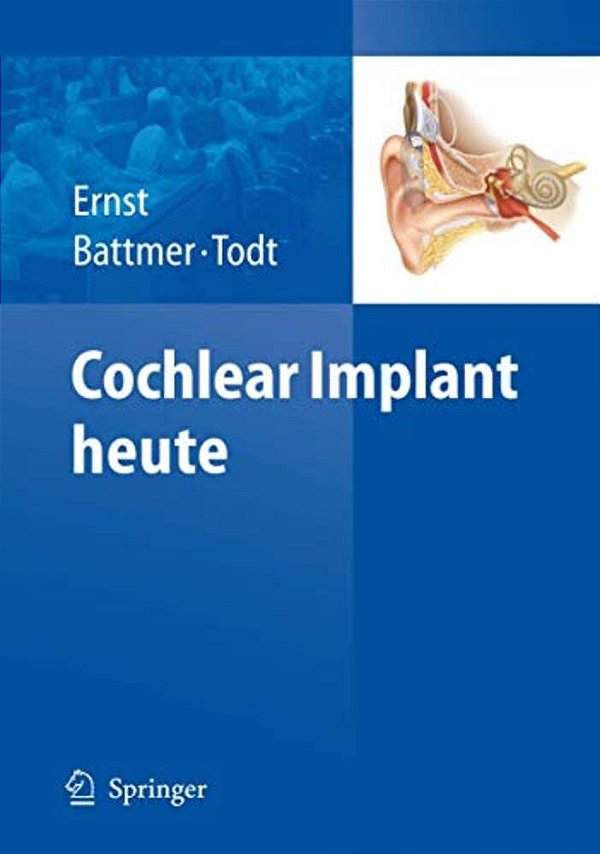 Cochlear Implant Heute-..