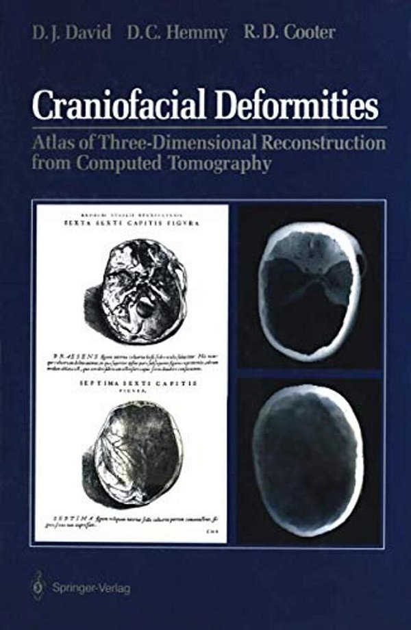 Craniofacial Deformities: Atlas Of Three-Dimensional Reconstruction From Computed Tomography-..