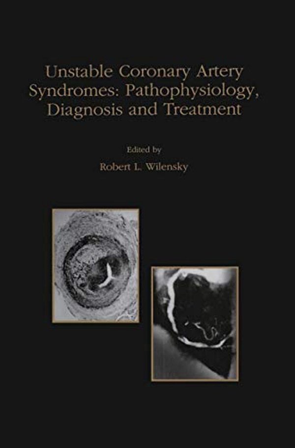 Unstable Coronary Artery Syndromes Pathophysiology, Diagnosis And Treatment-..