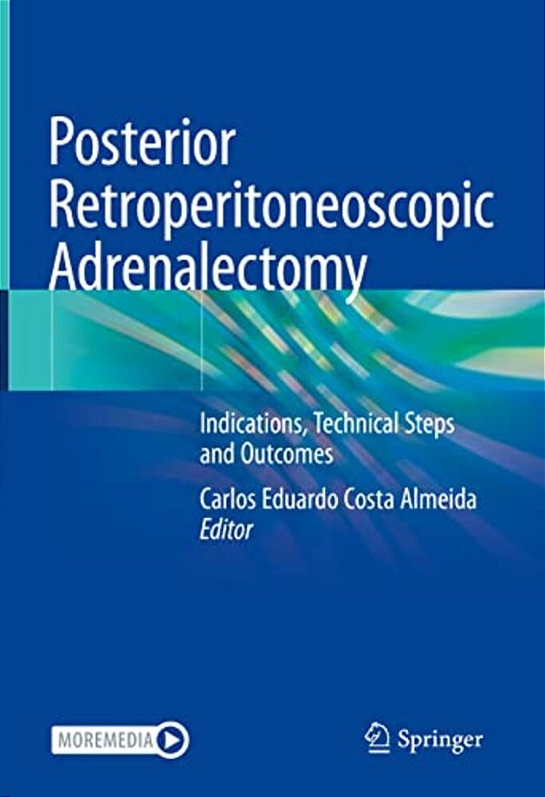Posterior Retroperitoneoscopic Adrenalectomy: Indications, Technical Steps And Outcomes-..