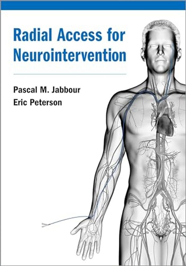 Radial Access For Neurointervention-..