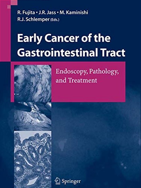 Early Cancer Of The Gastrointestinal Tract: Endoscopy, Pathology, And Treatment-..