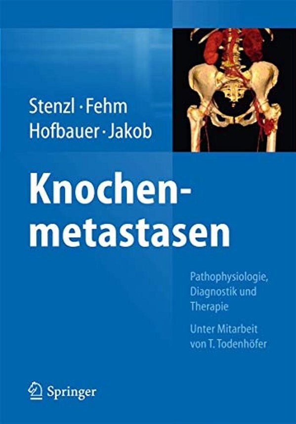 Knochenmetastasen: Pathophysiologie, Diagnostik Und Therapie - Unter Mitarbeit Von T. Todenhöfer-..
