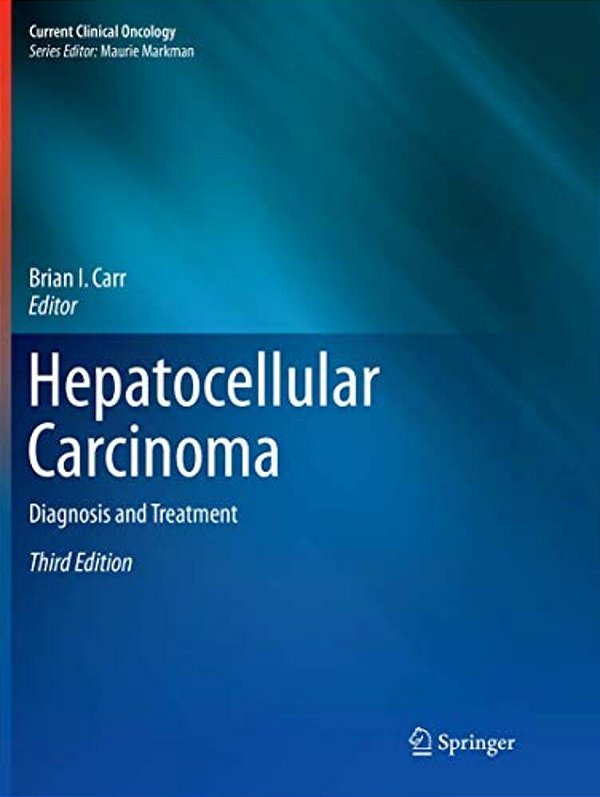 Hepatocellular Carcinoma: Diagnosis And Treatment-..
