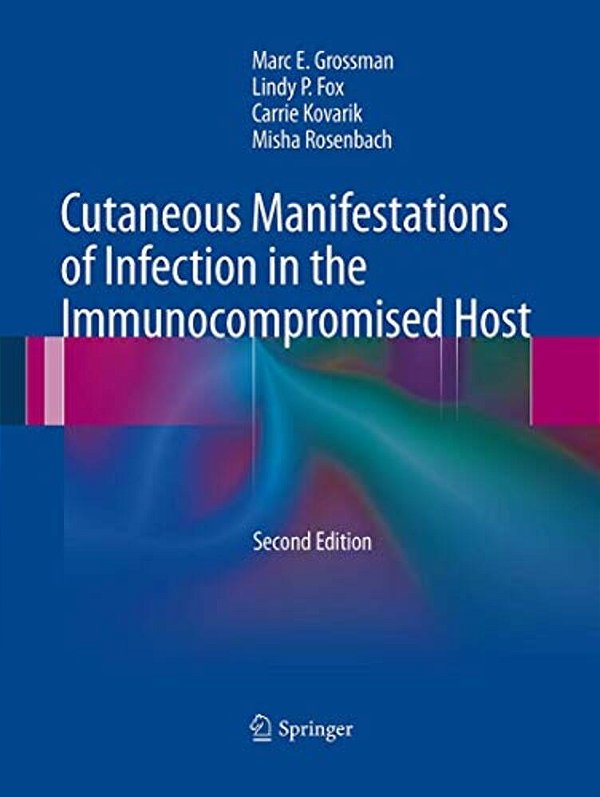 Cutaneous Manifestations Of Infection In The Immunocompromised Host-..