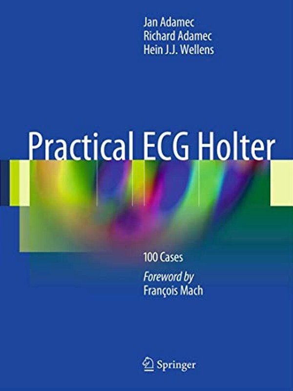 Practical Ecg Holter: 100 Cases-..