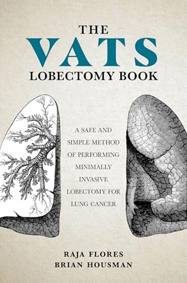 The Vats Lobectomy Book: A Safe And Simple Method Of Performing Minimally Invasive Lobectomy For Lung Cancer-..