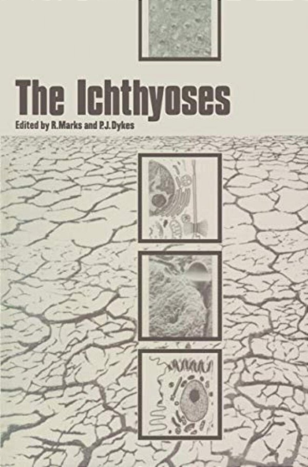 The Ichthyoses: Proceedings Of The 2ND Annual Clinically Orientated Symposium Of The European Society For Dermatological Research-..