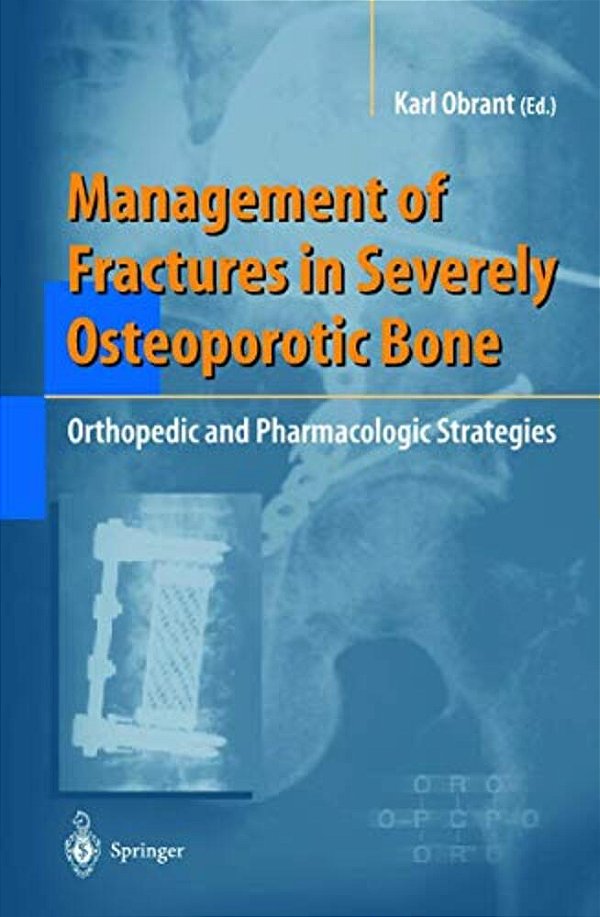 Management Of Fractures In Severely Osteoporotic Bone: Orthopedic And Pharmacologic Strategies-..