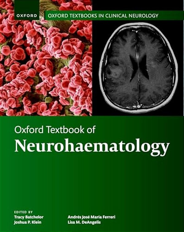 Oxford Textbook Of Neurohaematology-..