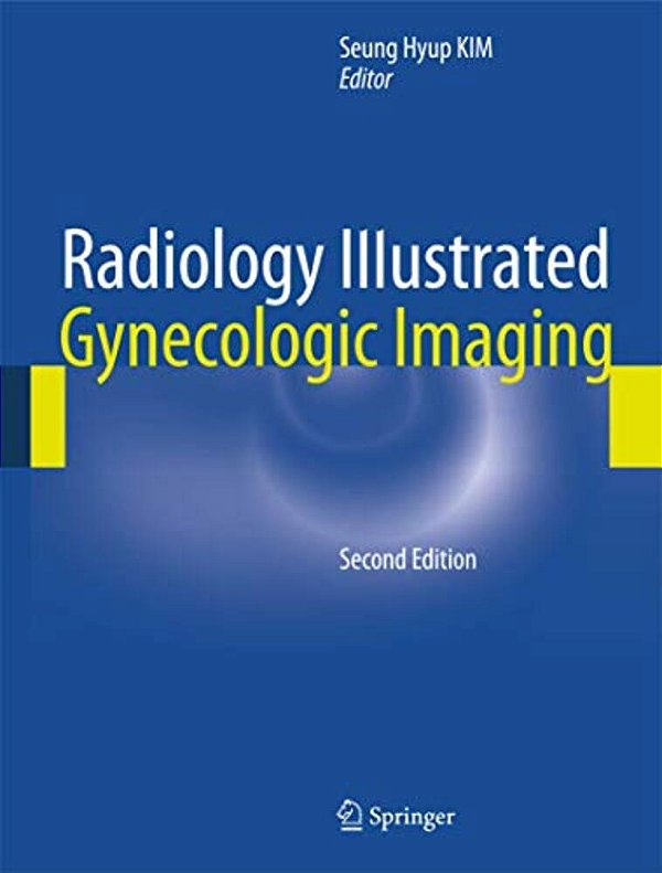 Radiology Illustrated: Gynecologic Imaging-..