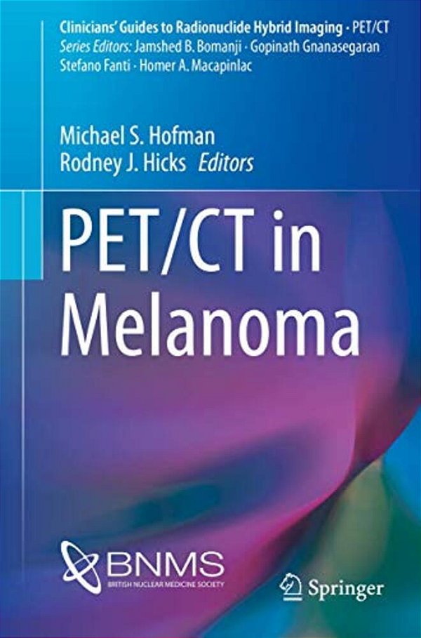 Pet/Ct In Melanoma-..