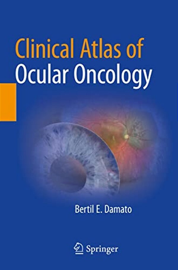 Clinical Atlas Of Ocular Oncology-..