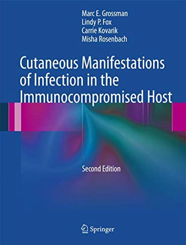 Cutaneous Manifestations Of Infection In The Immunocompromised Host-..