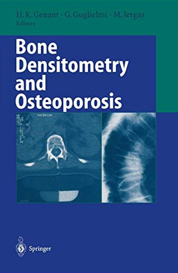 Bone Densitometry And Osteoporosis-..