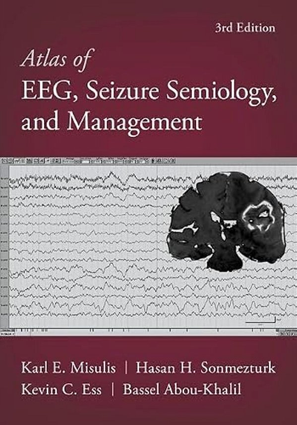 Atlas Of Eeg, Seizure Semiology, And Management-..