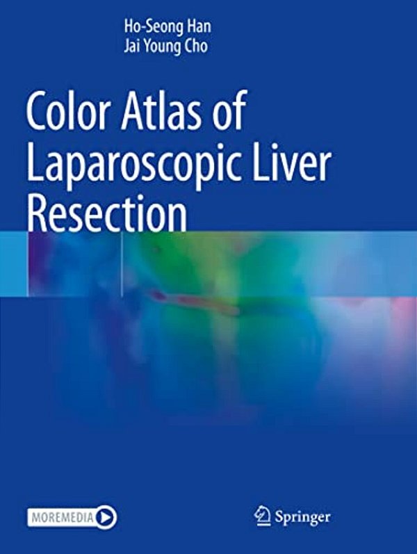 Color Atlas Of Laparoscopic Liver Resection-..
