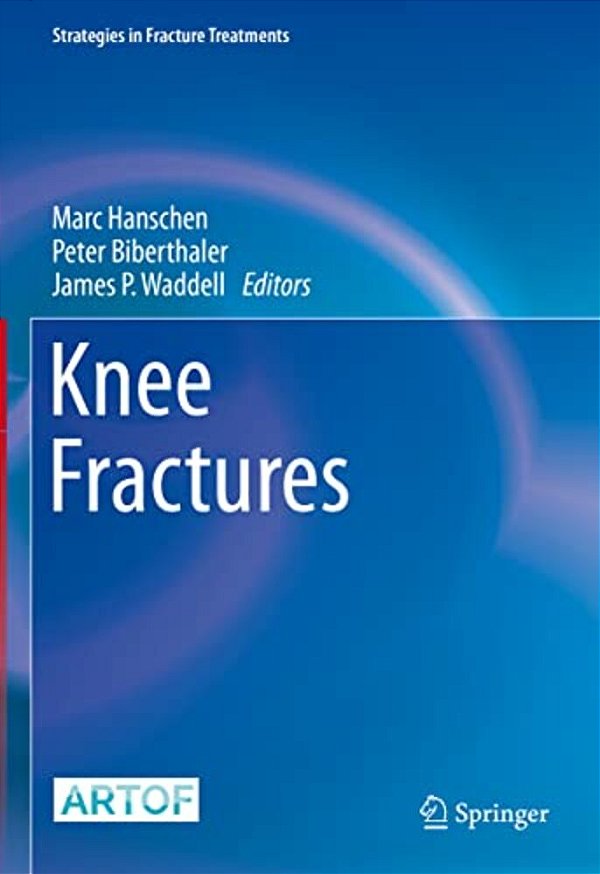 Knee Fractures-..