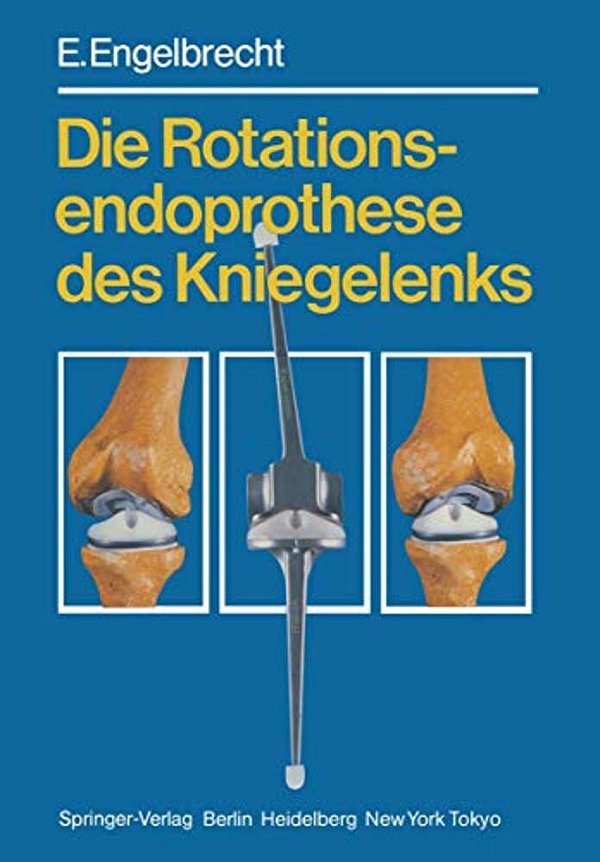 Die Rotationsendoprothese Des Kniegelenks-..