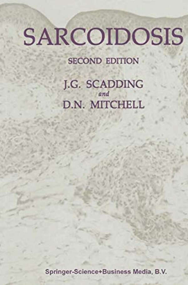 Sarcoidosis-..