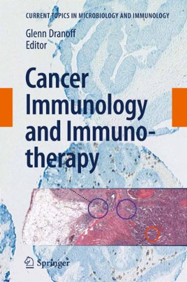 Cancer Immunology And Immunotherapy-..