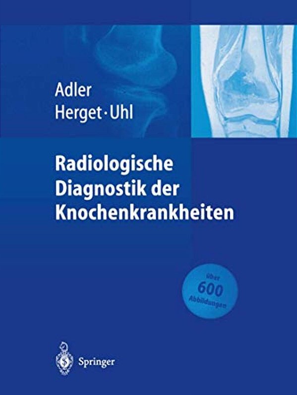Radiologische Diagnostik Der Knochenkrankheiten-..