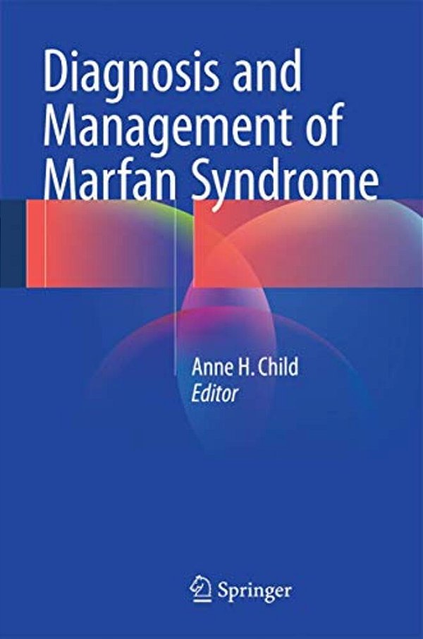 Diagnosis And Management Of Marfan Syndrome-..