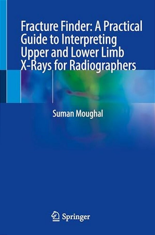 Fracture Finder: A Practical Guide To Interpreting Upper And Lower Limb X-Rays For Radiographers-..