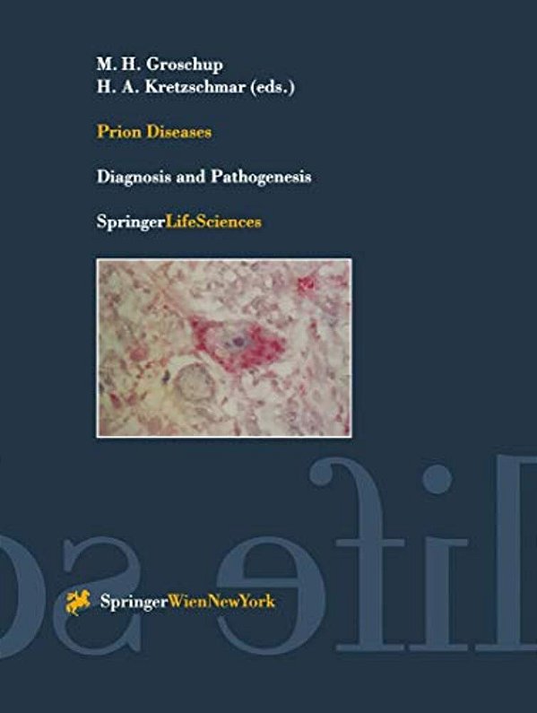 Prion Diseases: Diagnosis And Pathogenesis-..