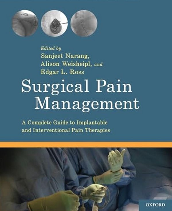 Surgical Pain Management: A Complete Guide To Implantable And Interventional Pain Therapies-..