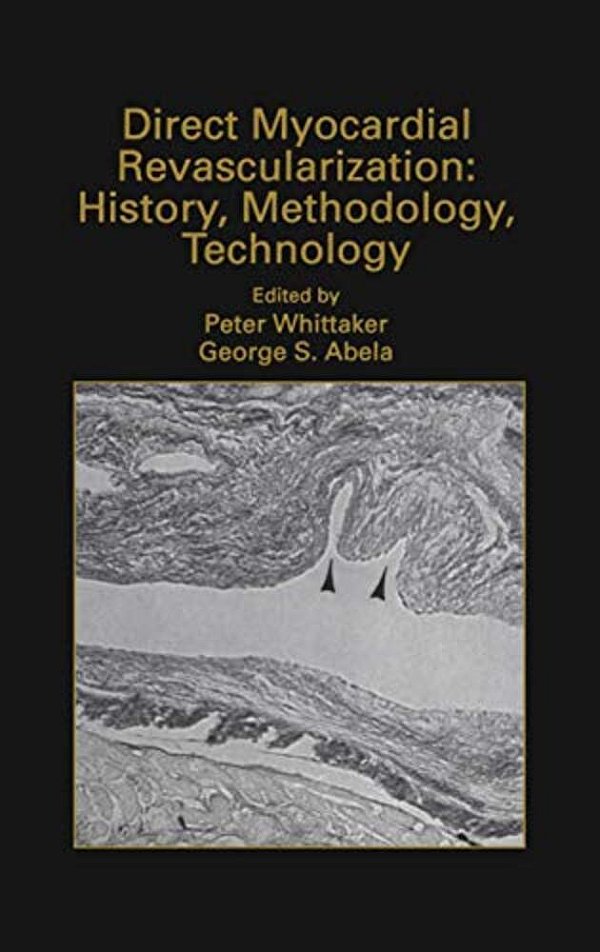 Direct Myocardial Revascularization: History, Methodology, Technology-..