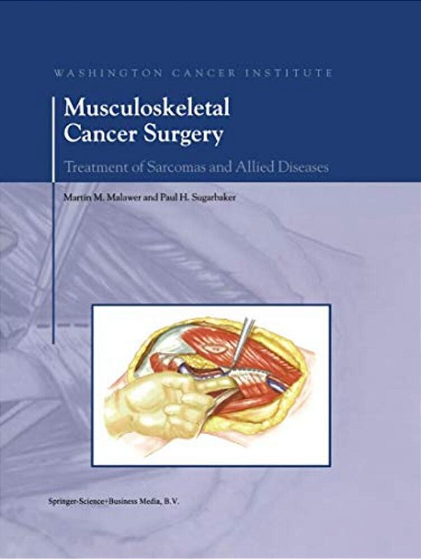 Musculoskeletal Cancer Surgery: Treatment Of Sarcomas And Allied Diseases-..