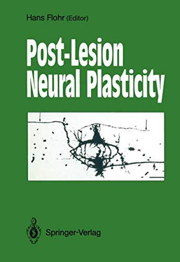 Post-Lesion Neural Plasticity-..