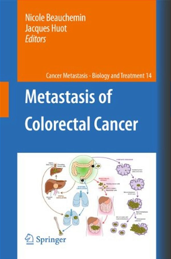 Metastasis Of Colorectal Cancer-..