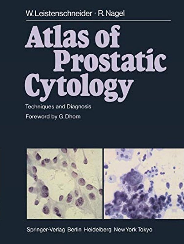 Atlas Of Prostatic Cytology: Techniques And Diagnosis-..