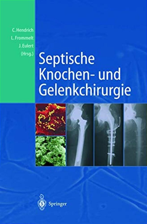 Septische Knochen-Und Gelenkchirurgie-..