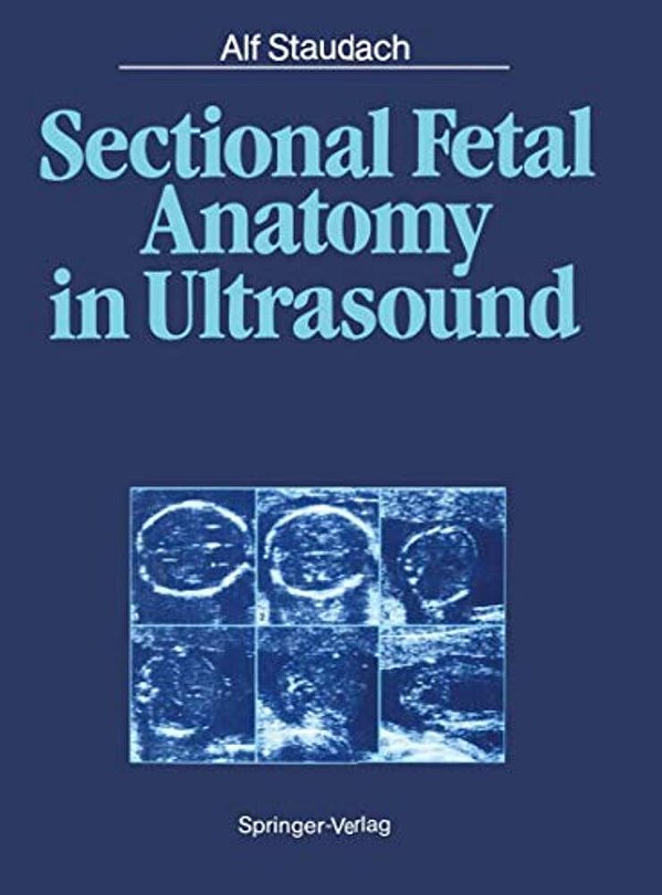 Sectional Fetal Anatomy In Ultrasound-..