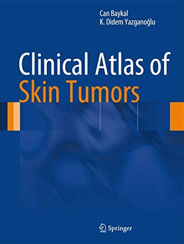 Clinical Atlas Of Skin Tumors-..