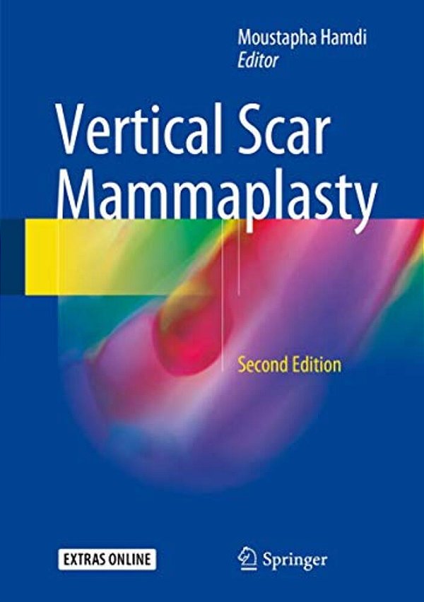 Vertical Scar Mammaplasty-..