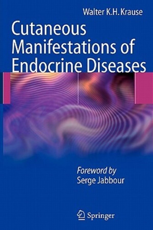 Cutaneous Manifestations Of Endocrine Diseases-..