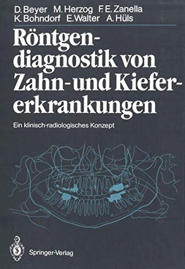Röntgendiagnostik Von Zahn- Und Kiefererkrankungen: Ein Klinisch-Radiologisches Konzept-..