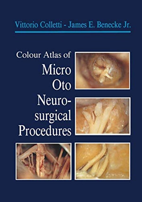 Colour Atlas Of Micro-Oto-neurosurgical Procedures-..