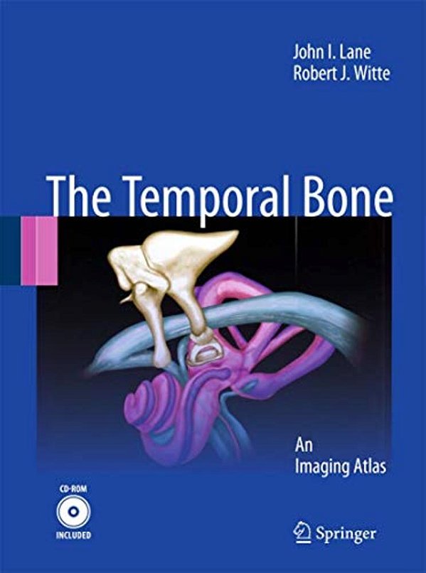 The Temporal Bone: An Imaging Atlas [With CD-ROM]-..