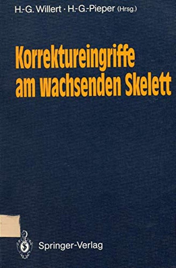 Korrektureingriffe Am Wachsenden Skelett-..