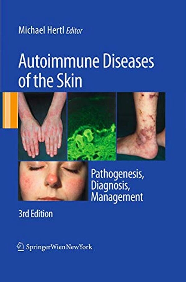 Autoimmune Diseases Of The Skin: Pathogenesis, Diagnosis, Management-..