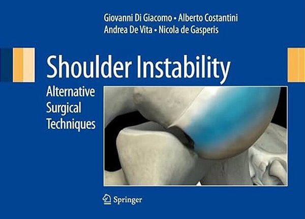 Shoulder Instability: Alternative Surgical Techniques-..